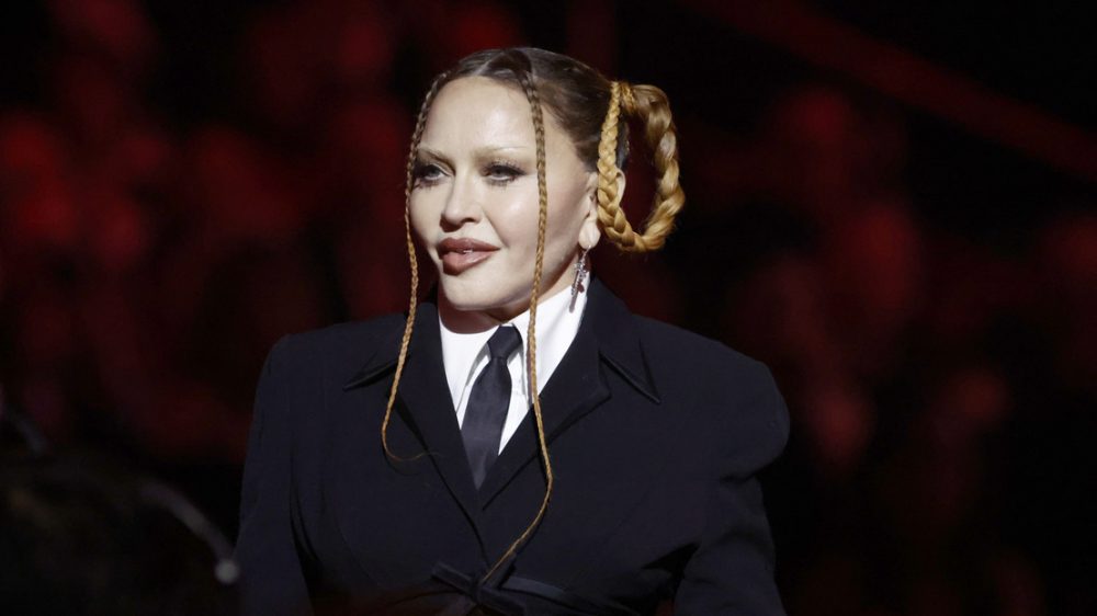 Madonna az arcplasztika rabja lett